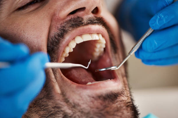 Best Urgent Dental Care for Toothaches in Goulding, FL